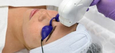 Eine Frau lässt sich im Gesicht einer Laserbehandlung unterziehen.